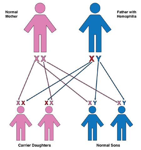 Hemophilia Inheritance Chart