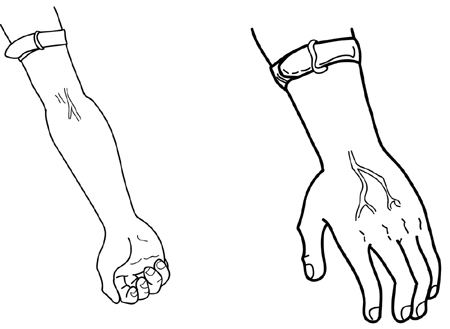 Vein Chart For Shooting Up