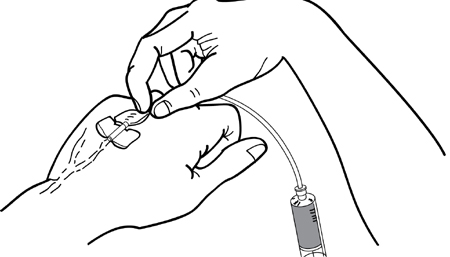 Fig 4-19 taping tubing Fig 4-19 taping tubing