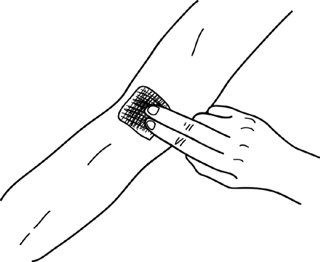 Fig 4-21 pressing down on site with gauze pad