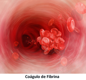 coágulo de fibrina coágulo de fibrina